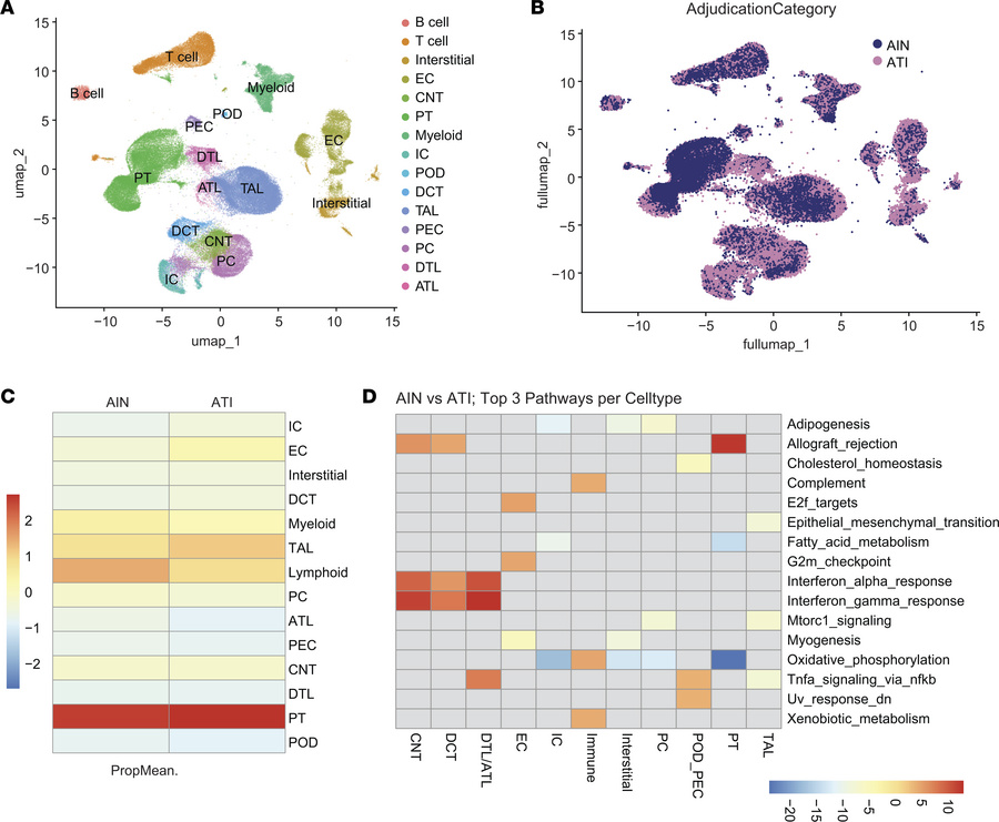 AIN cases have higher expression of signatures related to allograft reje...