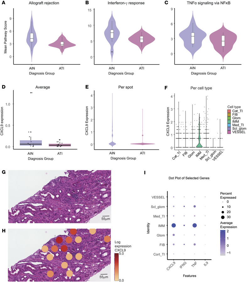 Spatial anchoring of immune-related pathways and genes.
(A) Average path...