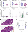 Spatial anchoring of immune-related pathways and genes.