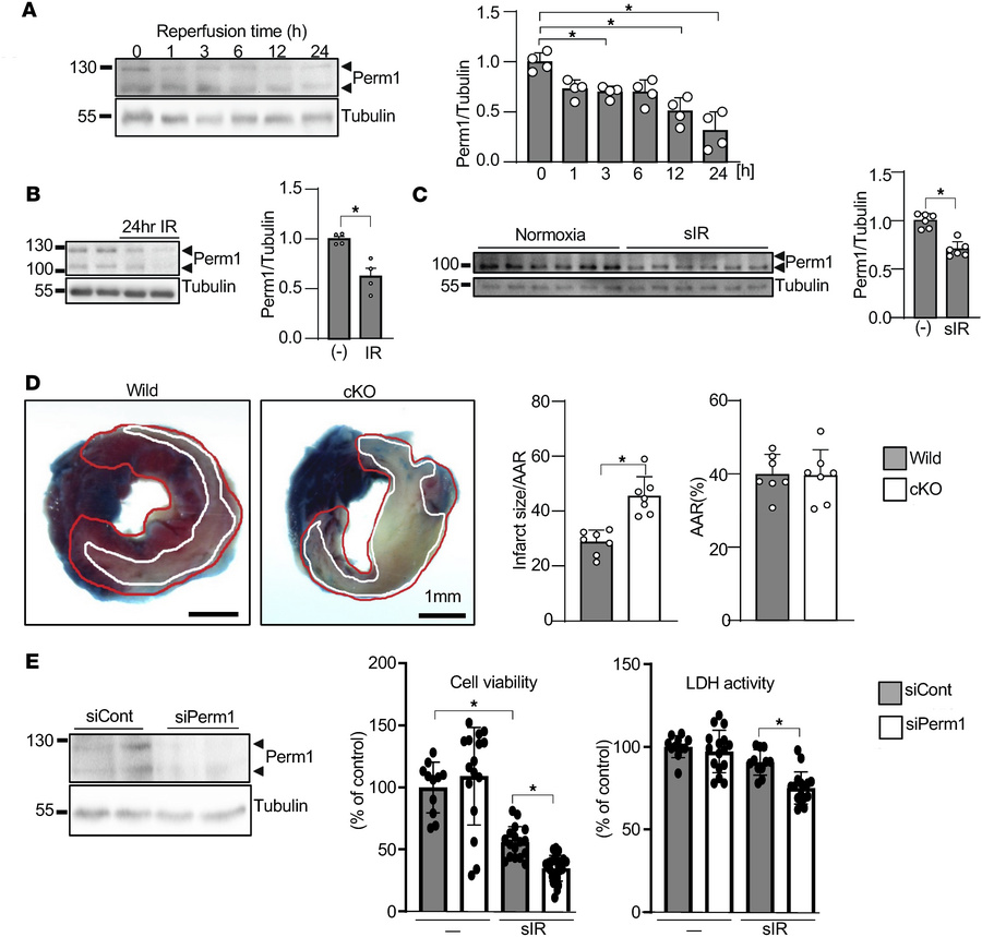Loss of Perm1 exacerbates IR injury.
(A and B) Perm1 was downregulated a...