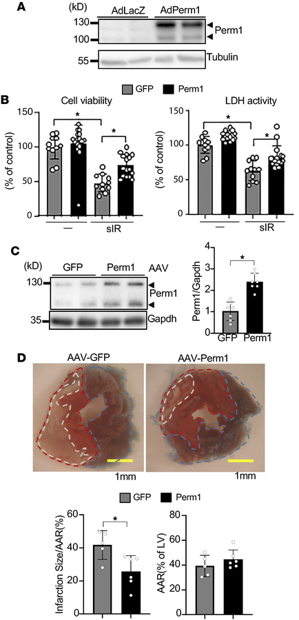 Perm1 overexpression attenuates IR injury.
(A) Perm1 upregulation with A...