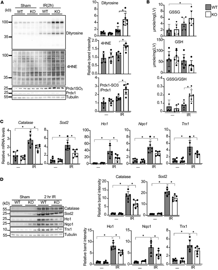 Loss of Perm1 exacerbates IR-induced oxidative stress.
(A) IR-induced ox...