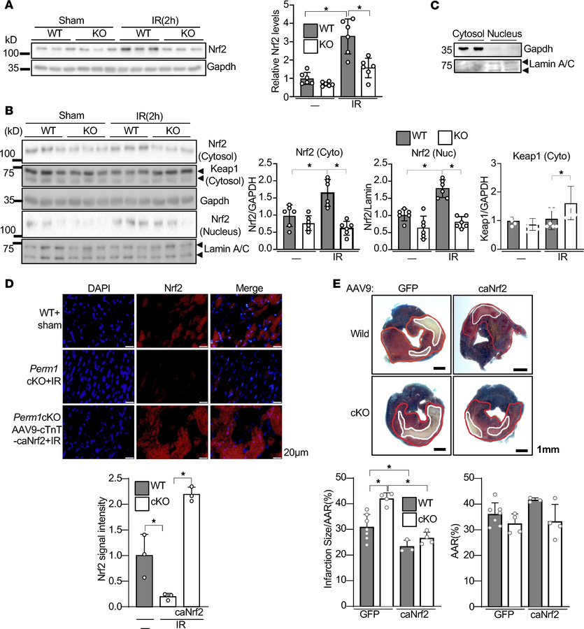 Perm1 promotes Nrf2 activation.
(A) IR-induced Nrf2 upregulation was inh...