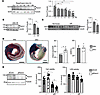 Loss of Perm1 exacerbates IR injury.