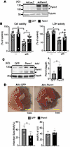 Perm1 overexpression attenuates IR injury.