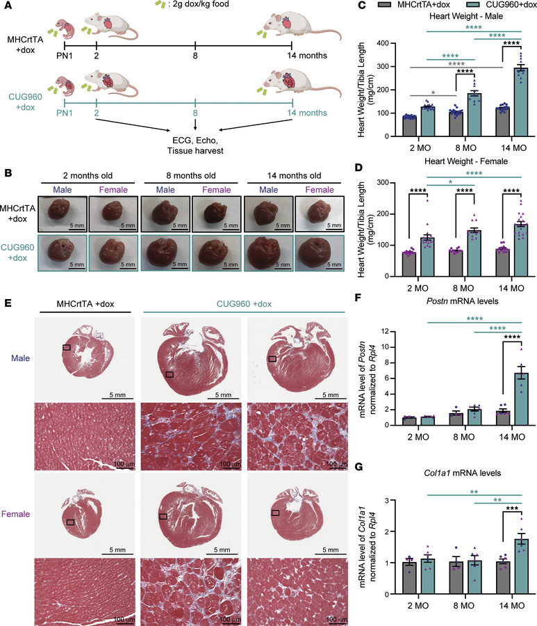 Long-term expression of CUGexp RNA resulted in progressive heart enlarge...