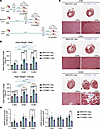 Heart weights and fibrosis marker expression, but not ventricular fibrosis,