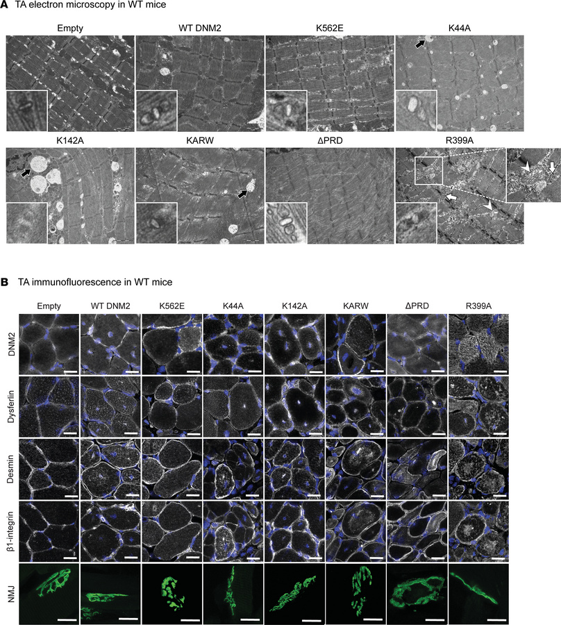 Expression of DNM2 variants in WT muscle impairs myofiber ultrastructure...
