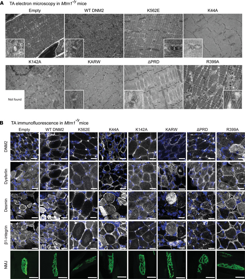 Overexpression of the lipid-binding-defective DNM2 K562E mutant improves...
