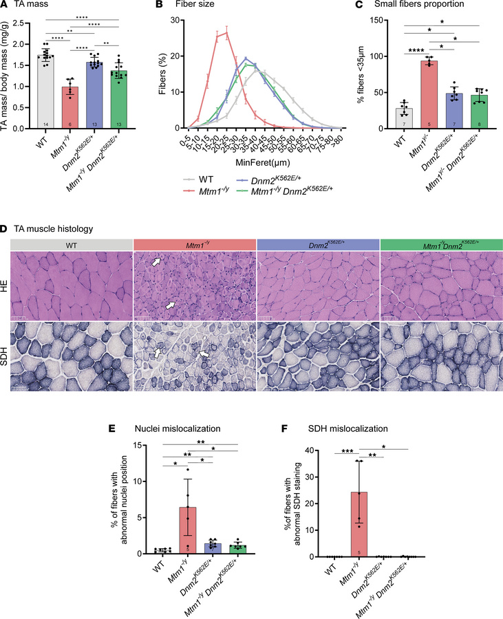 Systemic expression of the CMT neuropathy mutant K562 improves muscle at...