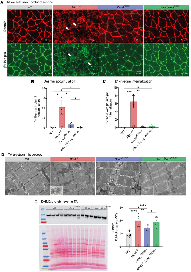 Systemic expression of the CMT neuropathy mutant K562 improves muscle or...