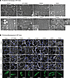 Expression of DNM2 variants in WT muscle impairs myofiber ultrastructure an