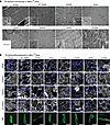 Overexpression of the lipid-binding-defective DNM2 K562E mutant improves ul