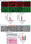 Systemic expression of the CMT neuropathy mutant K562 improves muscle organ