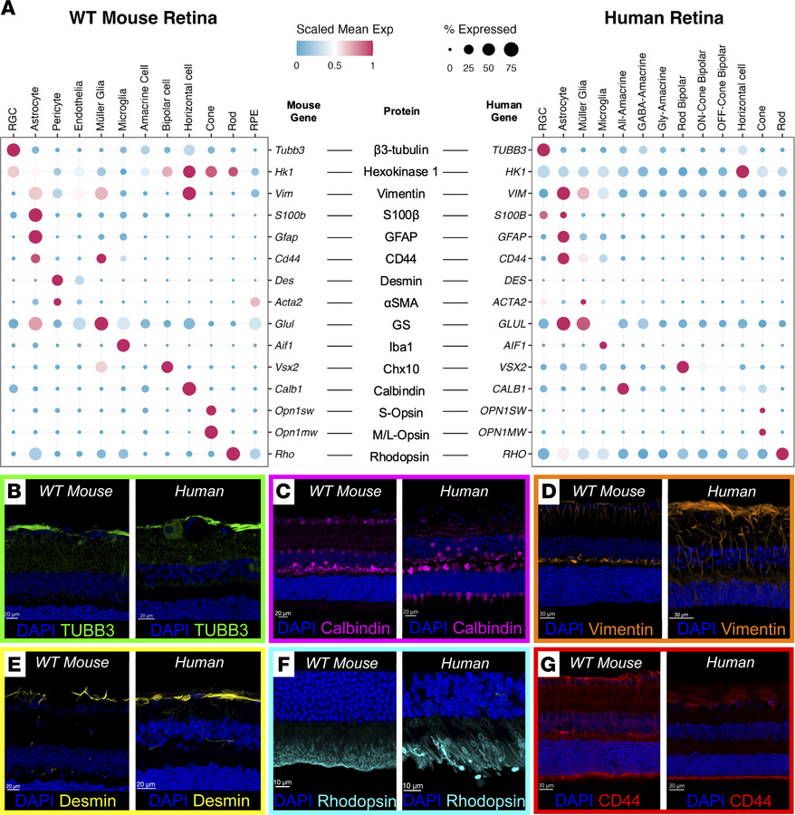 Cross-species comparison of human and mouse retina protein atlases highl...