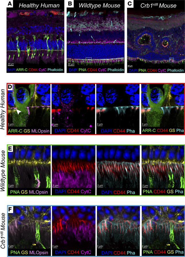 Super-resolution IBEX deconvolves the OLM retinal structure.
IBEX imagin...