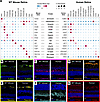 Cross-species comparison of human and mouse retina protein atlases highligh