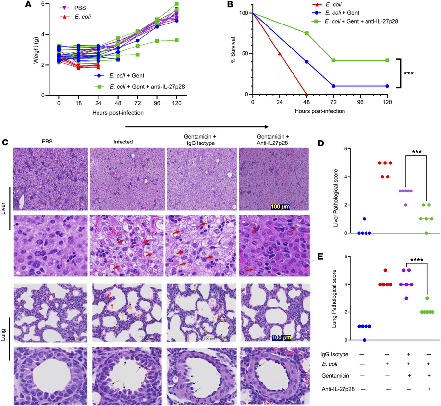 Improved survival with minimal liver and lung damage in septic pups that...