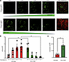 Improved bacterial phagocytosis and trafficking to lysosomes in neonatal BM