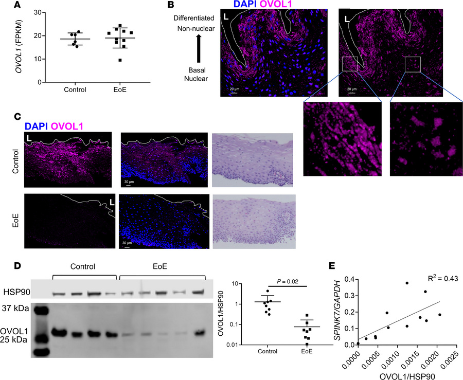Expression of OVOL1 in EoE biopsies.
(A) Expression of OVOL1 mRNA in EoE...