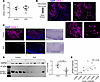 Expression of OVOL1 in EoE biopsies.