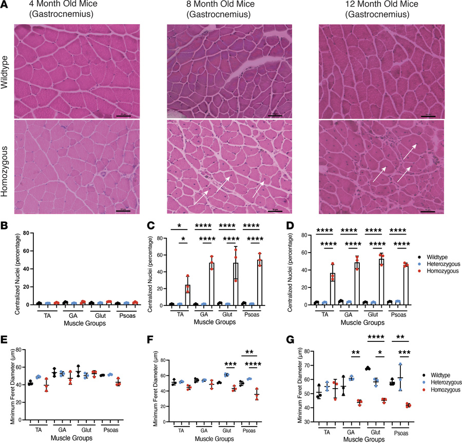 Histopathology of 4-, 8-, and 12-month-old mice.
(A) Representative H&am...
