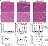 Histopathology of 4-, 8-, and 12-month-old mice.
