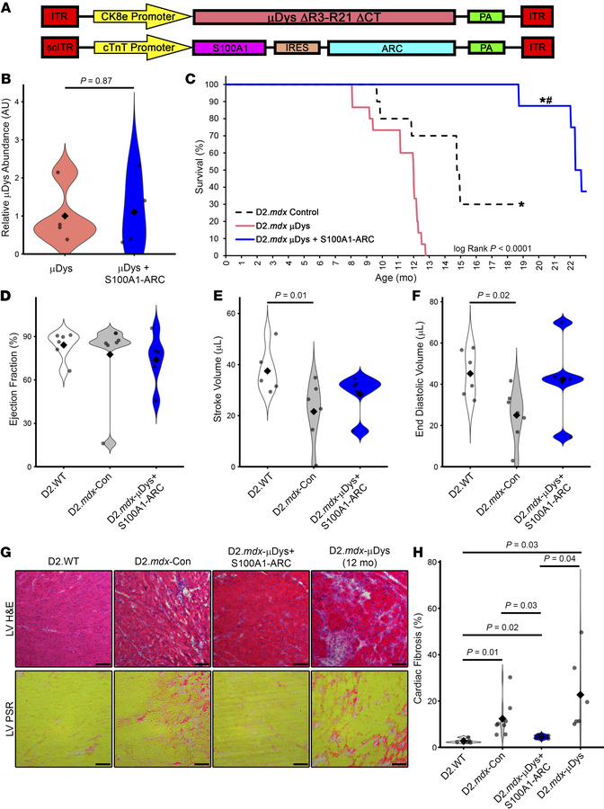 S100A1-ARC gene therapy prevents micro-dystrophin cardiotoxicity.
(A) Ma...