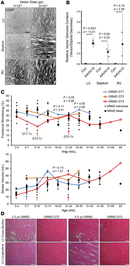 S100A1-ARC gene therapy in GRMD canines.
(A) Representative epifluoresce...