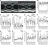 Progressive diastolic dysfunction and LV restriction in D2.mdx mice.