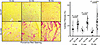 Progressive cardiac fibrosis in D2.mdx mice.
