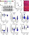 Bicistronic S100A1-ARC provides long-term benefits to D2.mdx cardiac functi