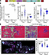 S100A1-ARC benefits D2.mdx skeletal muscle.