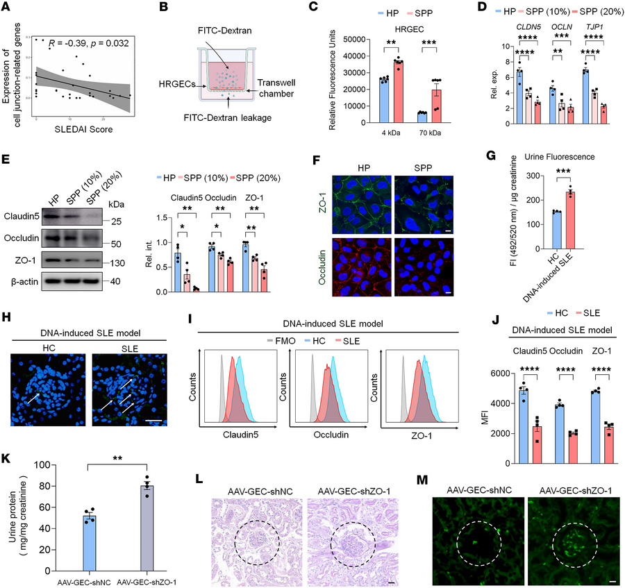 SLE plasma impairs the TJ barrier in HRGECs.
(A) The correlation between...