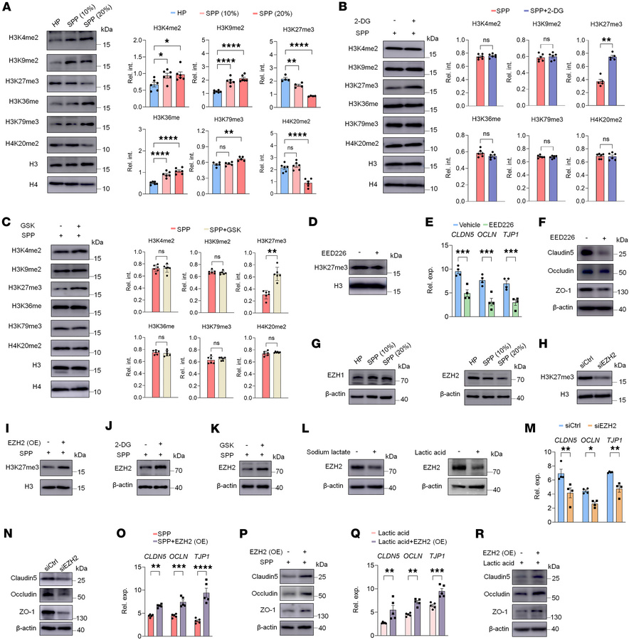 Abnormal glycolysis and subsequent lactate accumulation trigger EZH2 deg...