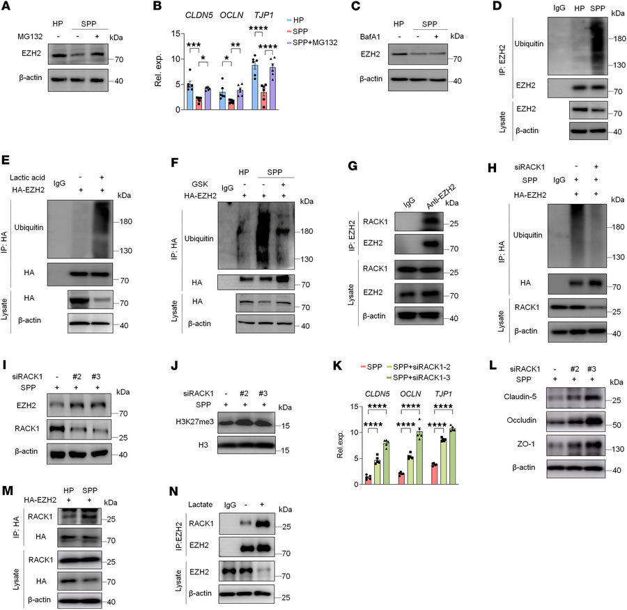 Lactate accumulation induces the ubiquitination of EZH2 in HRGECs.
(A an...