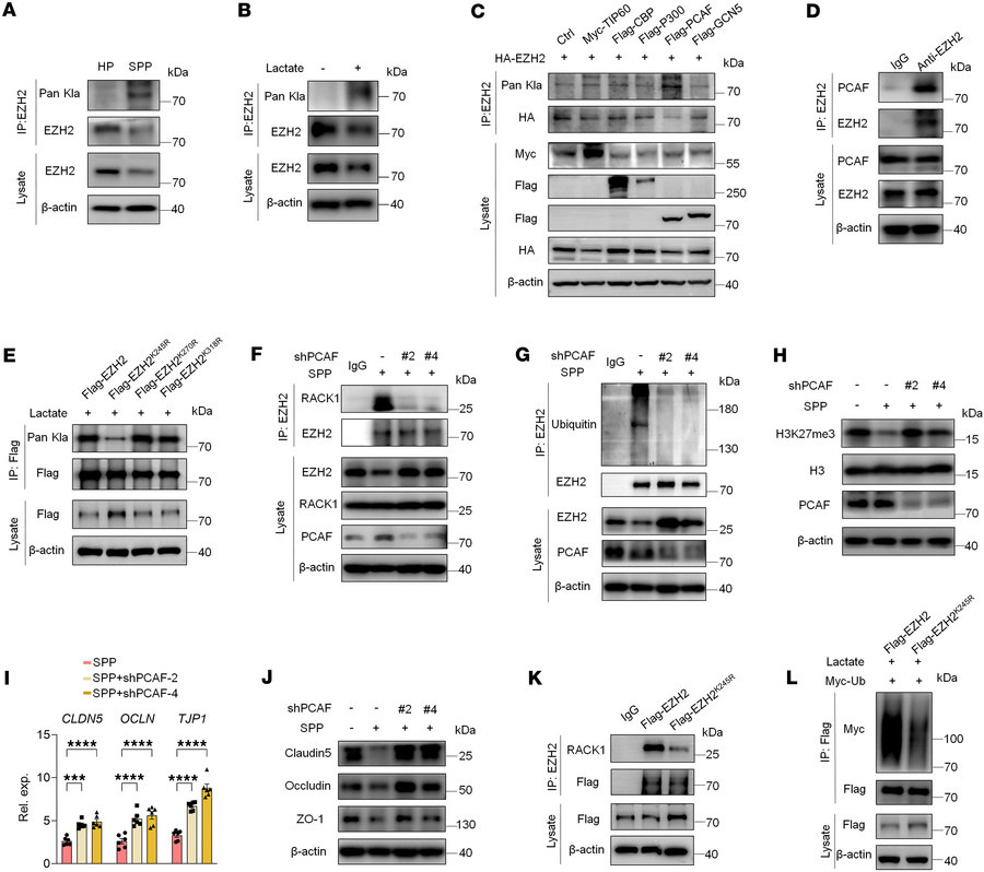 Lactate-induced EZH2 lactylation facilitates its ubiquitination through ...