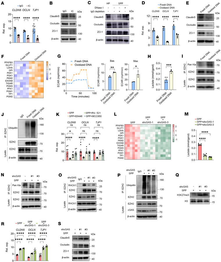 Sensing of oxidized DNA derived from SLE plasma by cGAS serves as the in...