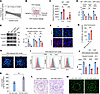 SLE plasma impairs the TJ barrier in HRGECs.