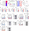 SLE plasma impairs the TJ barrier in HRGECs through glycolytic shift–driven