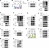 Lactate accumulation induces the ubiquitination of EZH2 in HRGECs.