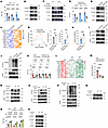 Sensing of oxidized DNA derived from SLE plasma by cGAS serves as the initi