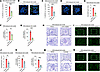 RU.521 and oxamate exert a therapeutic effect by restoring TJ barrier damag