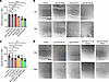 Results of astrocyte gap closure assay.