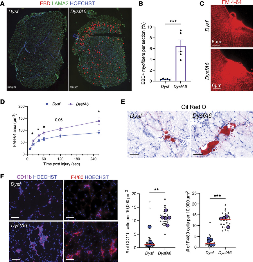 Muscle lacking both dysferlin and ANXA6 (DysfA6 muscle) has more sarcole...