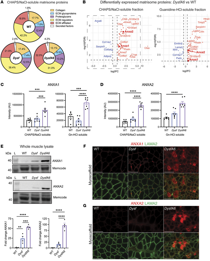 Increased ANXA1 and ANXA2 in DysfA6 muscle and in decellularized myoscaf...