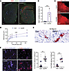 Muscle lacking both dysferlin and ANXA6 (DysfA6 muscle) has more sarcolemma