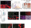 EBD uptake patterns differ between mdx and Dysf myofibers.