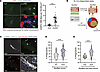 Enhanced CASP3 expression and macrophage phagocytosis of myofibers with imp
