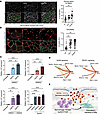 Elevated ANXA1 and ANXA2 expression in DysfA6 ECM promotes expression of Cs